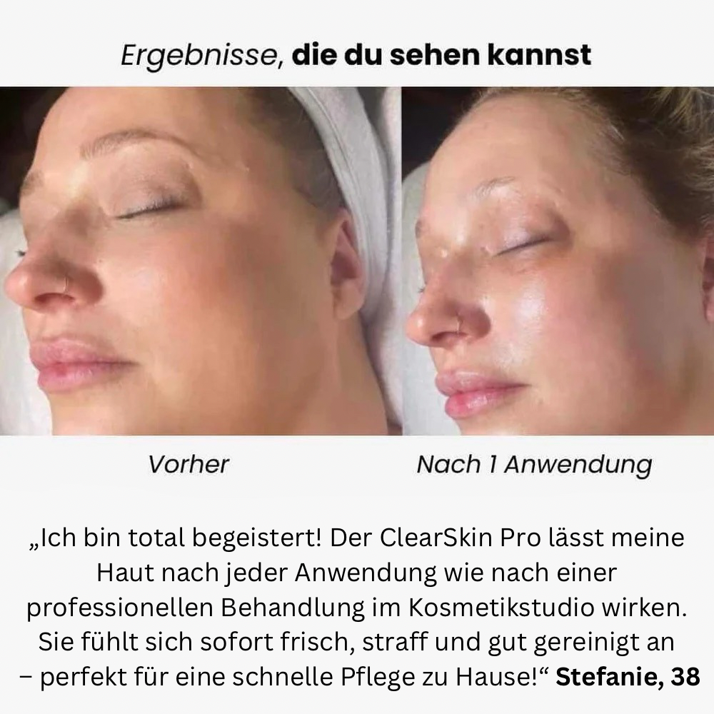 Vitalità ClearSkin Pro